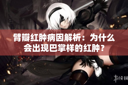 臂瓣紅腫病因解析：為什么會出現(xiàn)巴掌樣的紅腫？